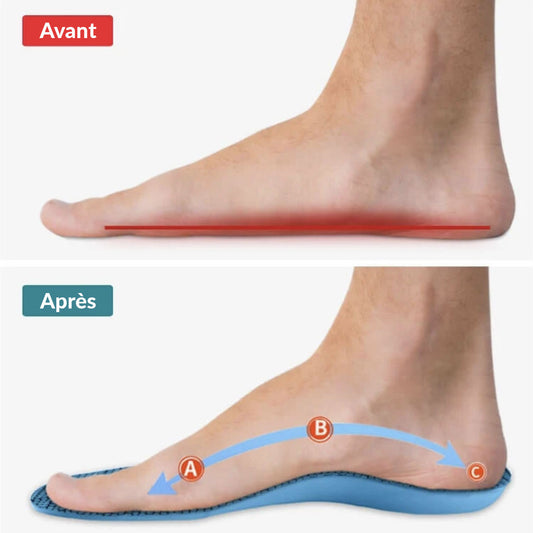 SteppyConfort - Semelles orthopédiques
