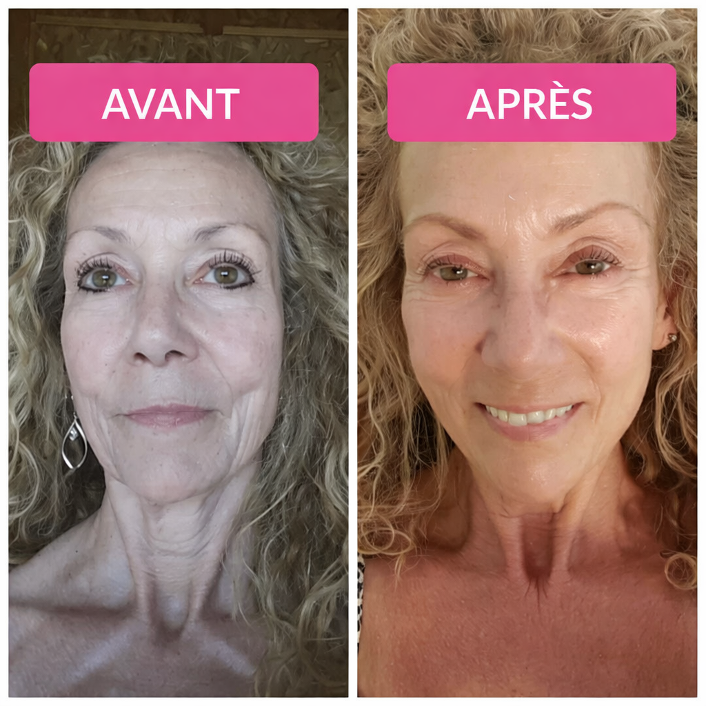 Sérum Vibriance Super C