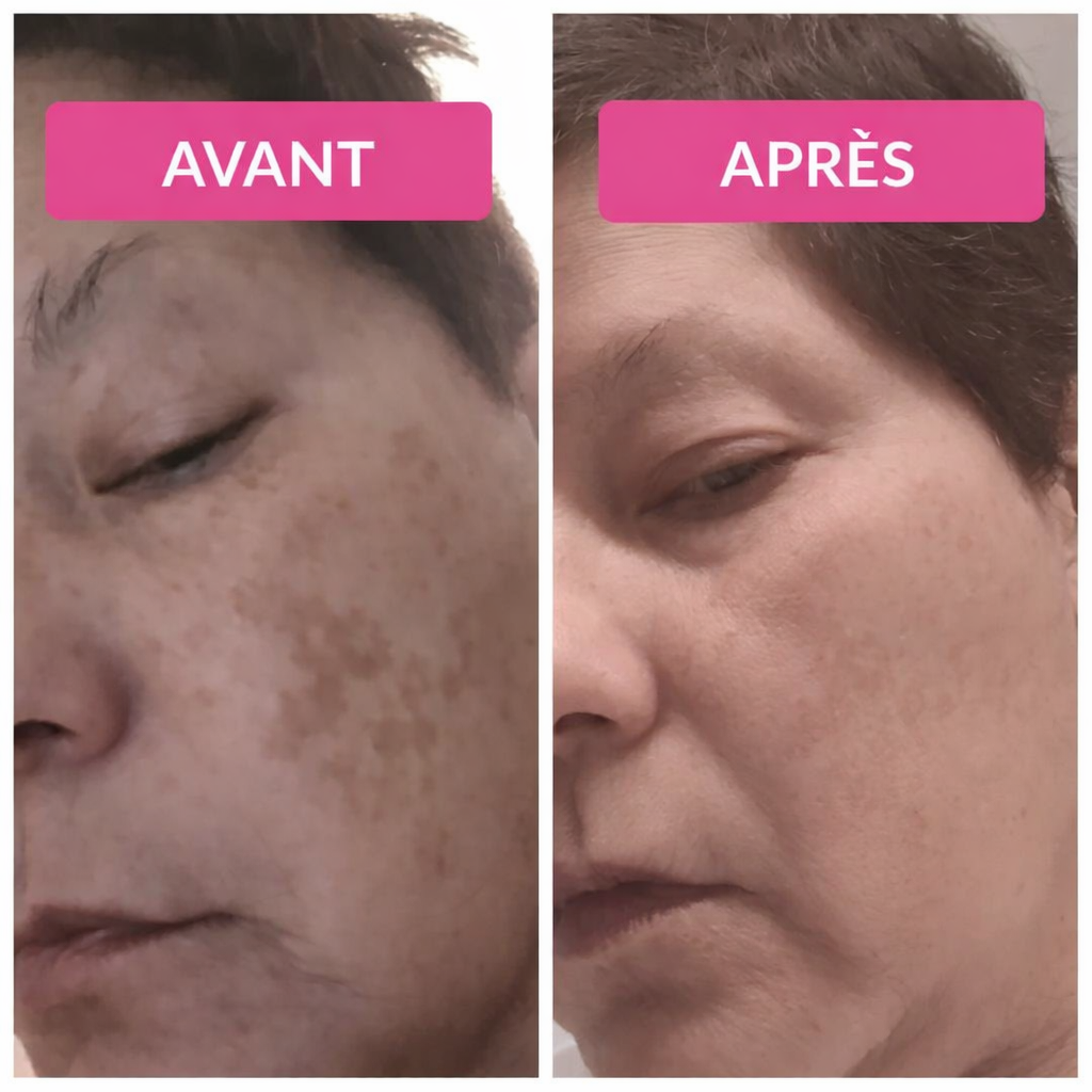 Sérum Vibriance Super C