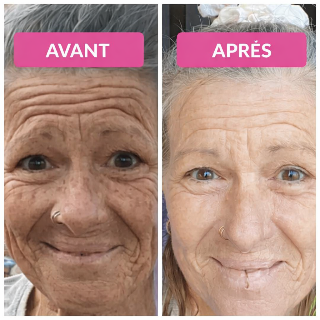 Sérum Vibriance Super C